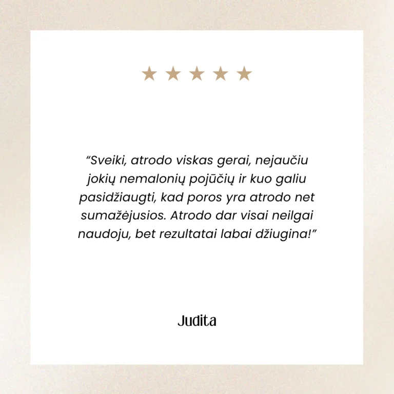 atsiliepimai